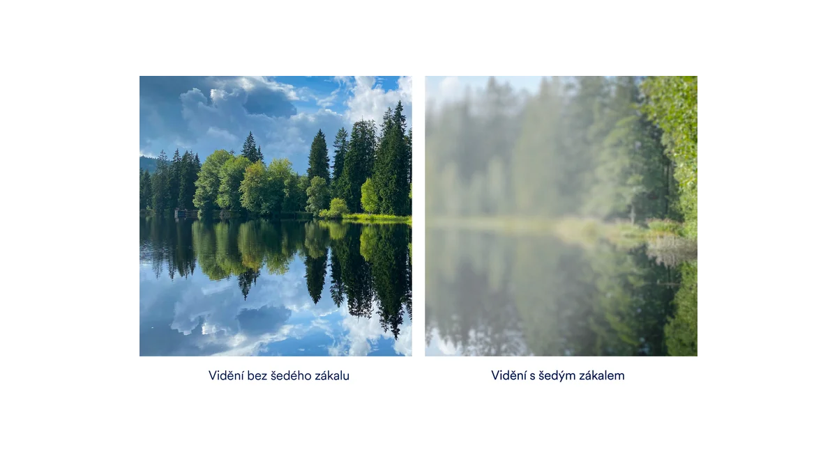 Poruchy zraku: Jak je vidí lidé kolem nás?
